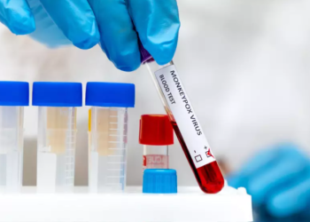 Денсаулық сақтау министрлігі маймыл шешегіне қатысты мәлімдеме жасады